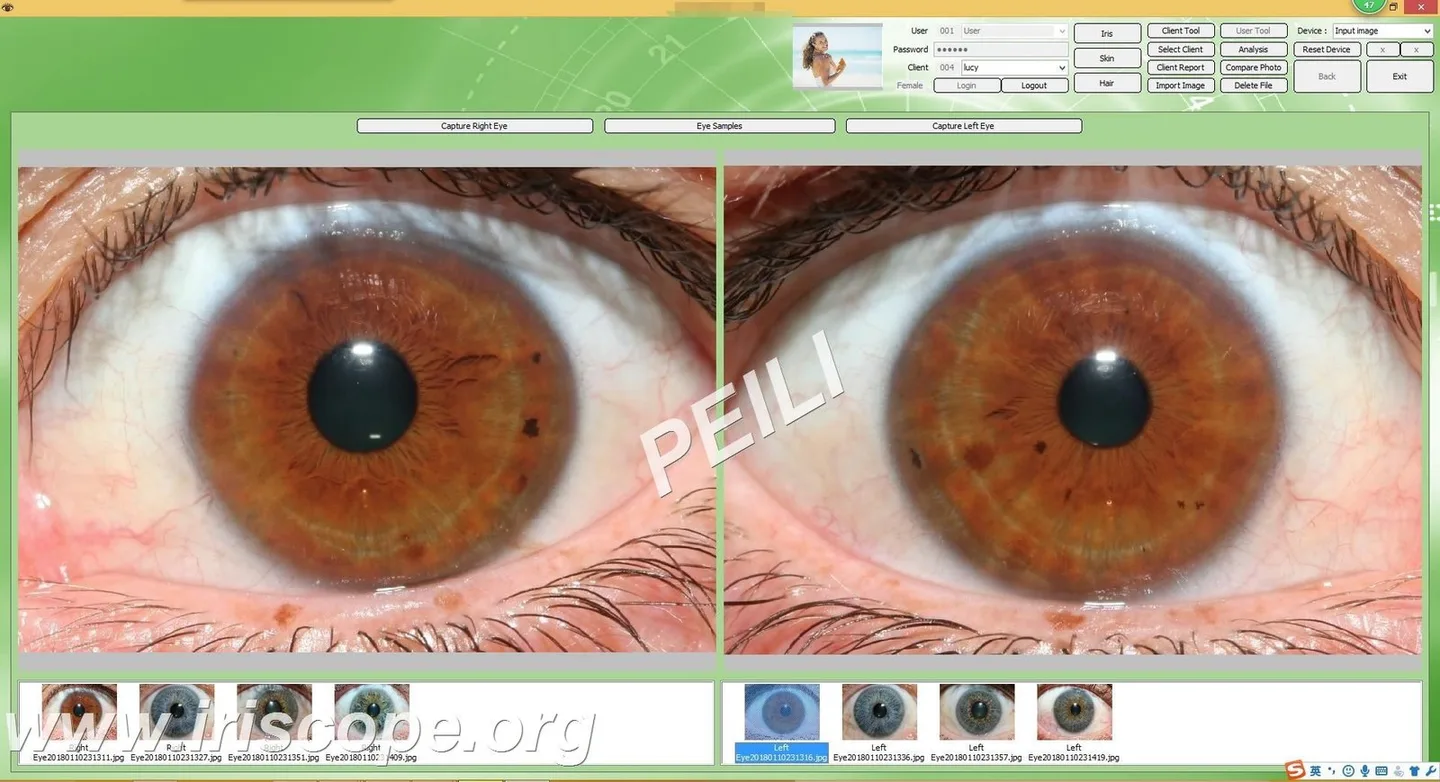 Iridoscopio per iridologia: quale scegliere e come usarlo in una SPA in Italia — MAIKONG IRIDOLOGY CAMERA (42).JPG