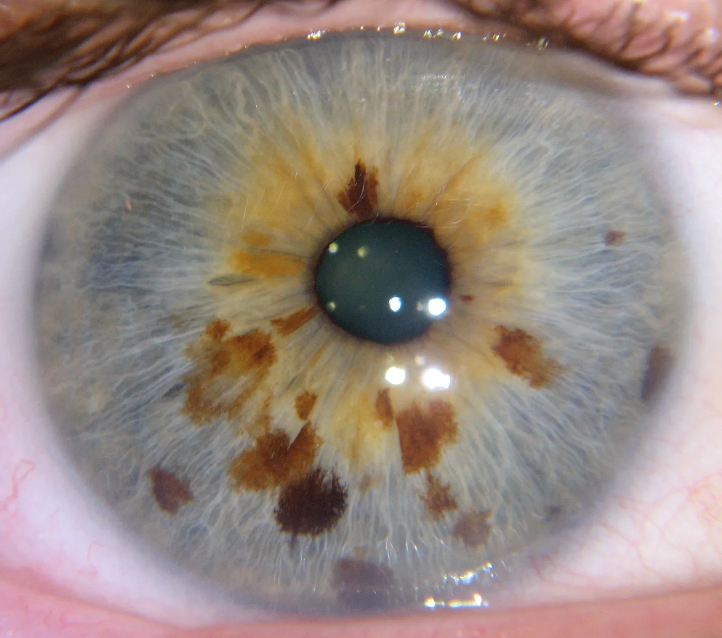 Iridoscopio portatile: guida pratica per centri benessere in Italia — MAIKONG IRIDOLOGY CAMERA (1604).jpg