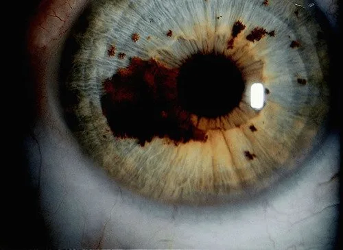 Iridoscopio professionale: quale scegliere per uso formativo e benessere in Italia — MAIKONG IRIDOLOGY CAMERA (1523).jpg