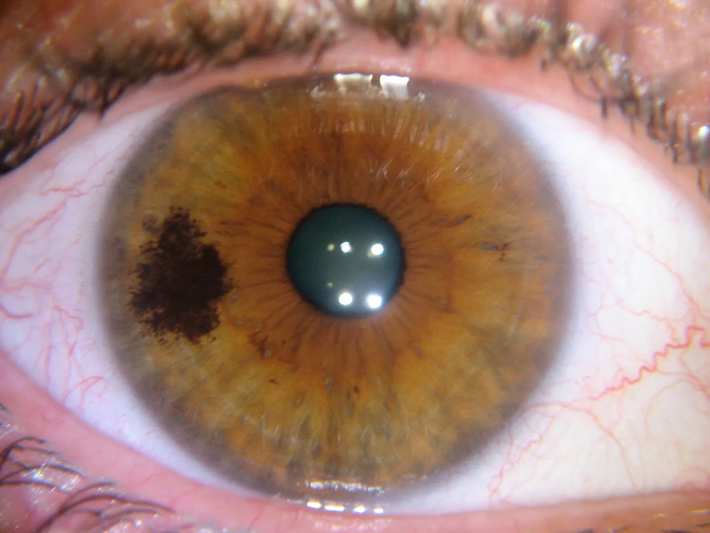 Iridoscopio professionale: quale scegliere per uso formativo e benessere in Italia — MAIKONG IRIDOLOGY CAMERA (1564).jpg