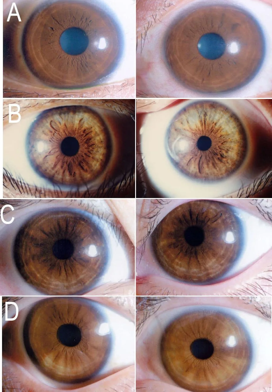 Iridoscopio professionale: quale scegliere per uso formativo e benessere in Italia — MAIKONG IRIDOLOGY CAMERA (1705).jpg