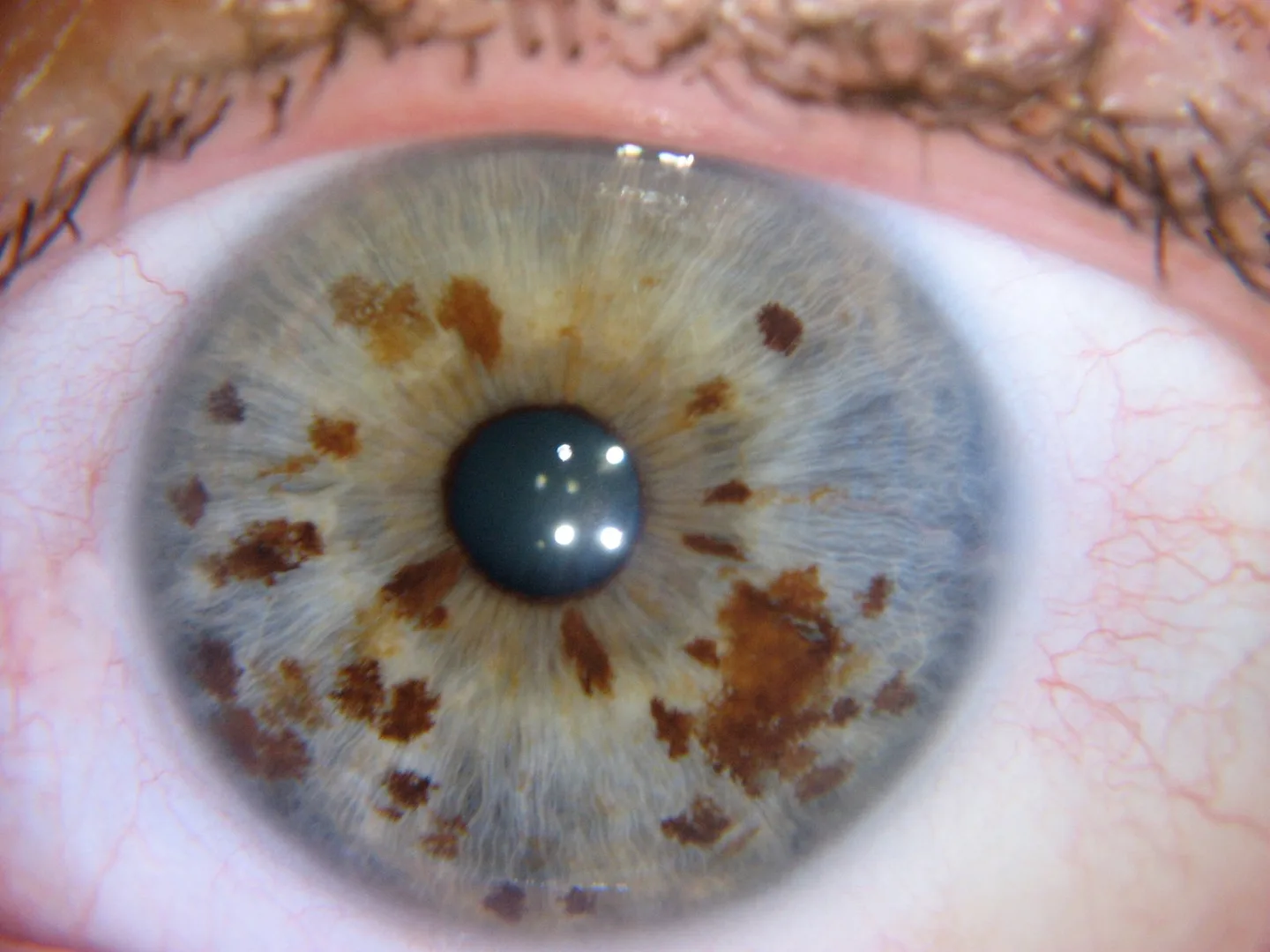 Iridoscopio professionale: quale scegliere per uso formativo e benessere in Italia — MAIKONG IRIDOLOGY CAMERA (1605).jpg