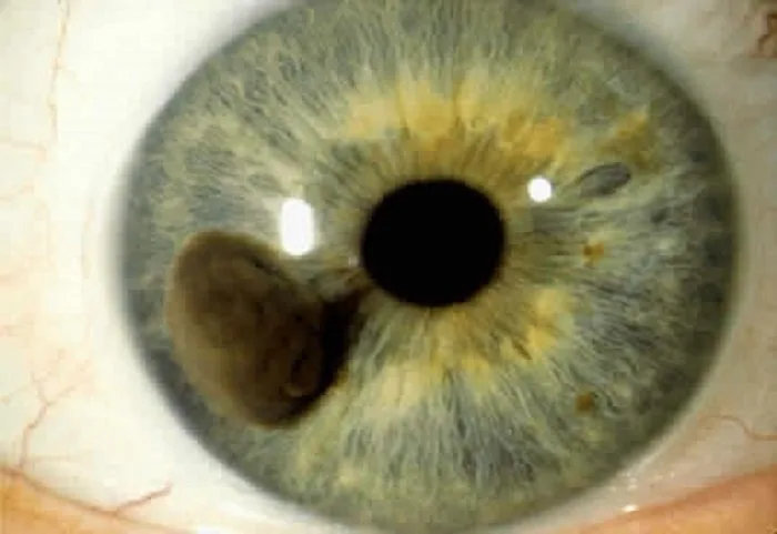 Iridoscopio professionale: quale scegliere per uso formativo e benessere in Italia — MAIKONG IRIDOLOGY CAMERA (1521).jpg