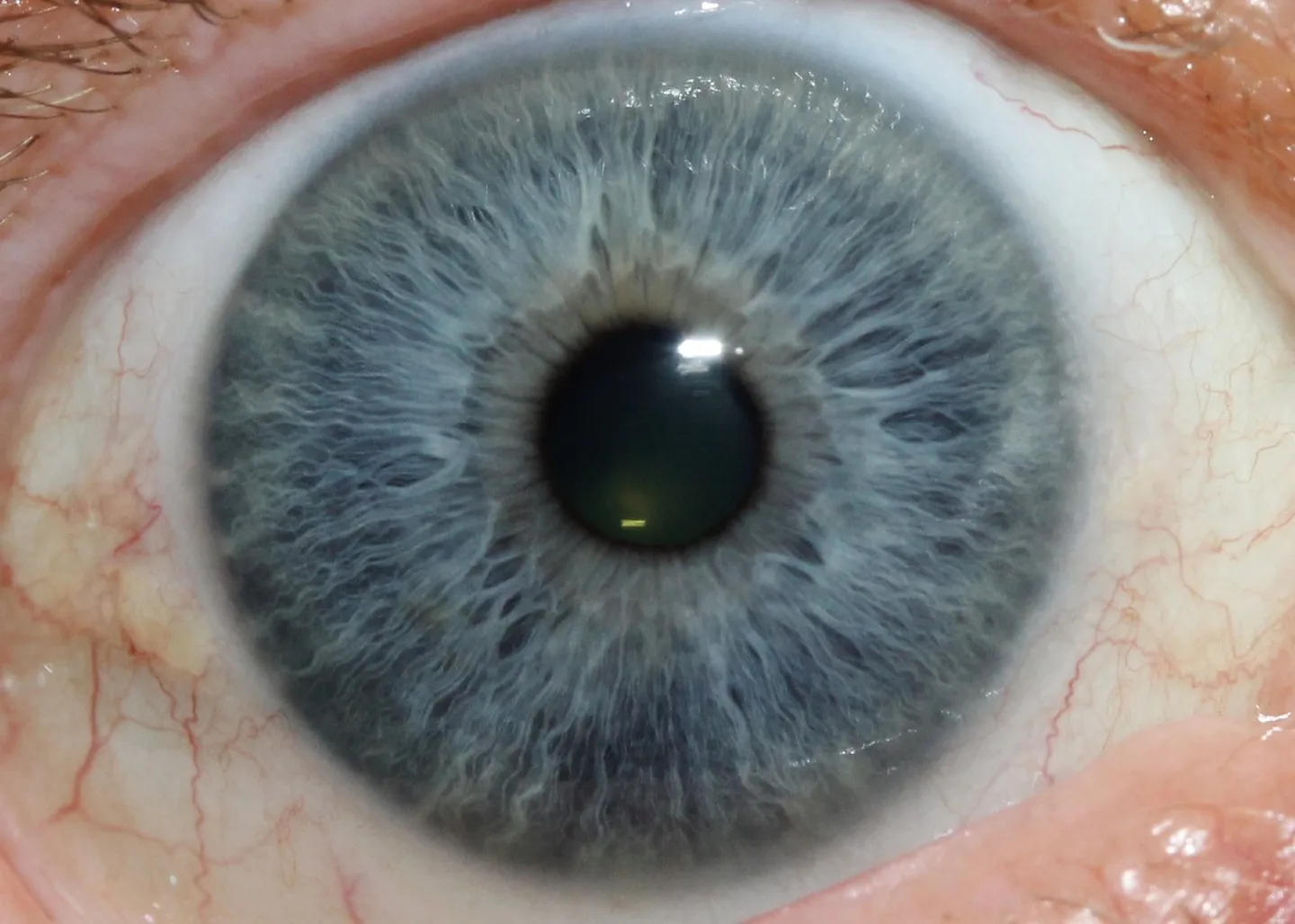 Iridoscopio professionale: quale scegliere per uso formativo e benessere in Italia — MAIKONG IRIDOLOGY CAMERA (2454).jpg