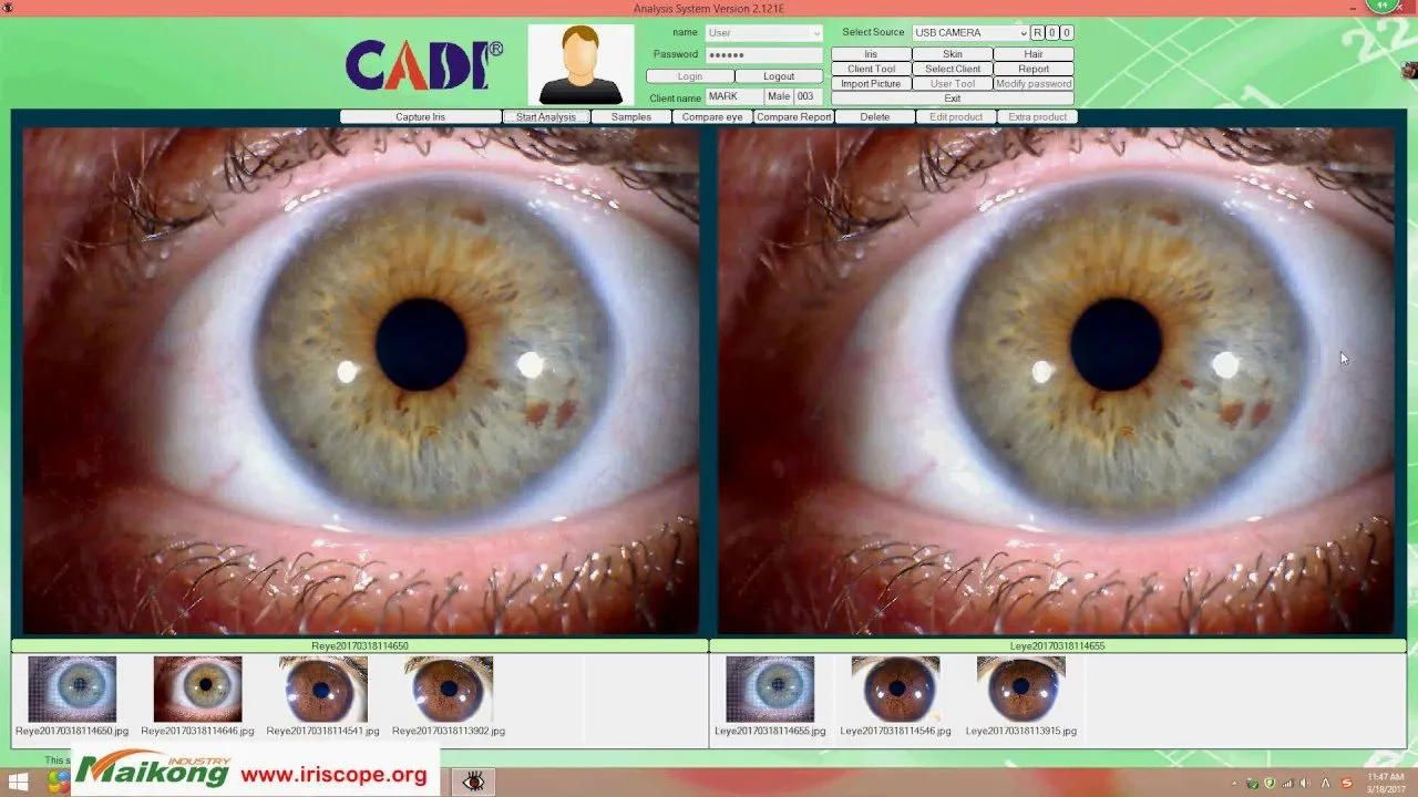 Vendita apparecchiature per iridologia: cosa serve ai distributori di strumenti per naturopatia in Italia — MAIKONG IRIDOLOGY CAMERA (3953).jpg