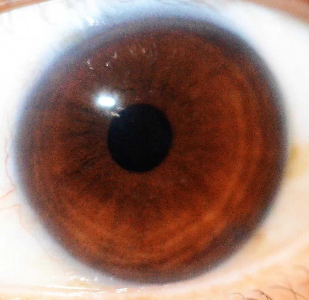 Vendita iridoscopi in Italia: guida pratica per operatori olistici che vogliono offrire il servizio — MAIKONG IRIDOLOGY CAMERA (1585).jpg