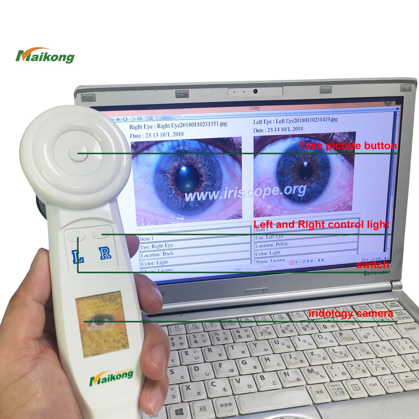Come configurare flussi di archiviazione immagini e schede cliente per iridologia in Italia — MAIKONG IRIDOLOGY CAMERA (3858).jpg