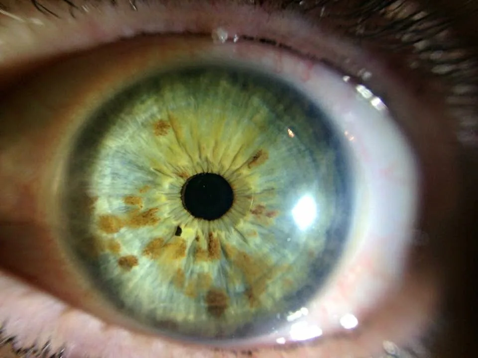 Come configurare flussi di archiviazione immagini e schede cliente per iridologia in Italia — MAIKONG IRIDOLOGY CAMERA (1525).jpg