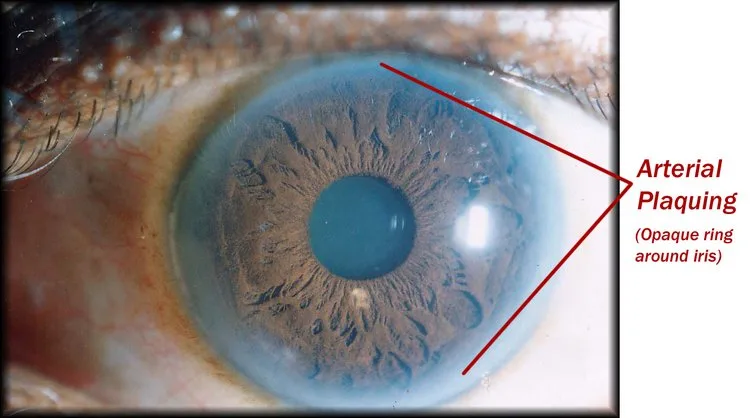 Corsi di iridologia: guida pratica per fornitori di farmacie ed erboristerie in Italia — MAIKONG IRIDOLOGY CAMERA (1571).jpg
