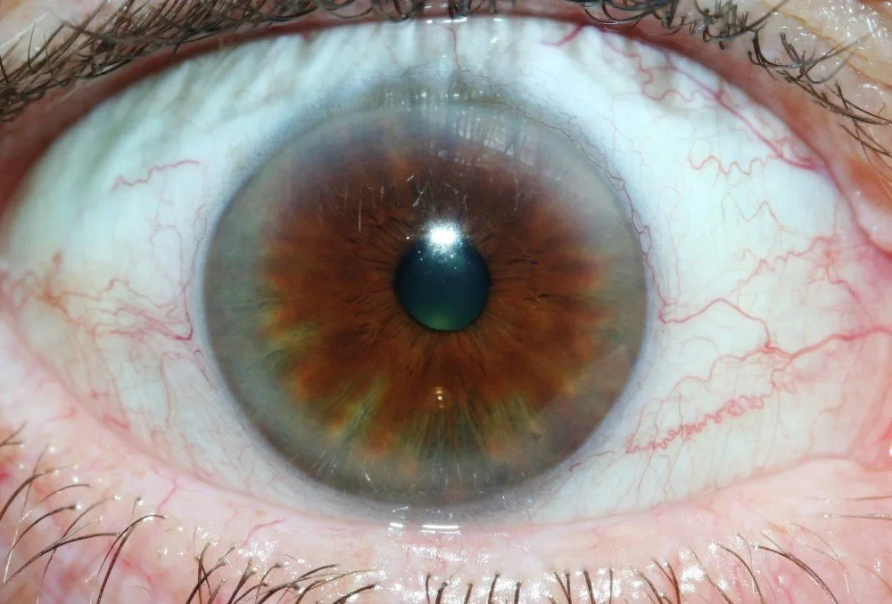 Corso avanzato di iridologia: cosa sapere prima di iscriversi in Italia — MAIKONG IRIDOLOGY CAMERA (1553).jpg