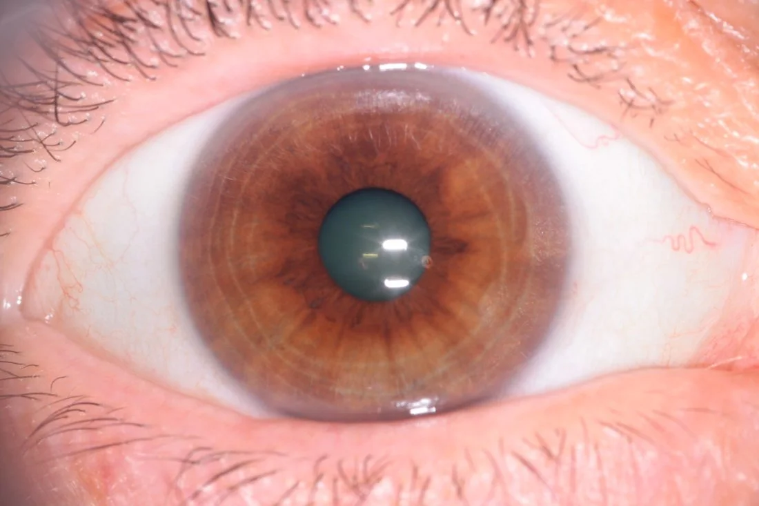 Corso avanzato di iridologia: cosa sapere prima di iscriversi in Italia — MAIKONG IRIDOLOGY CAMERA (1534).jpg