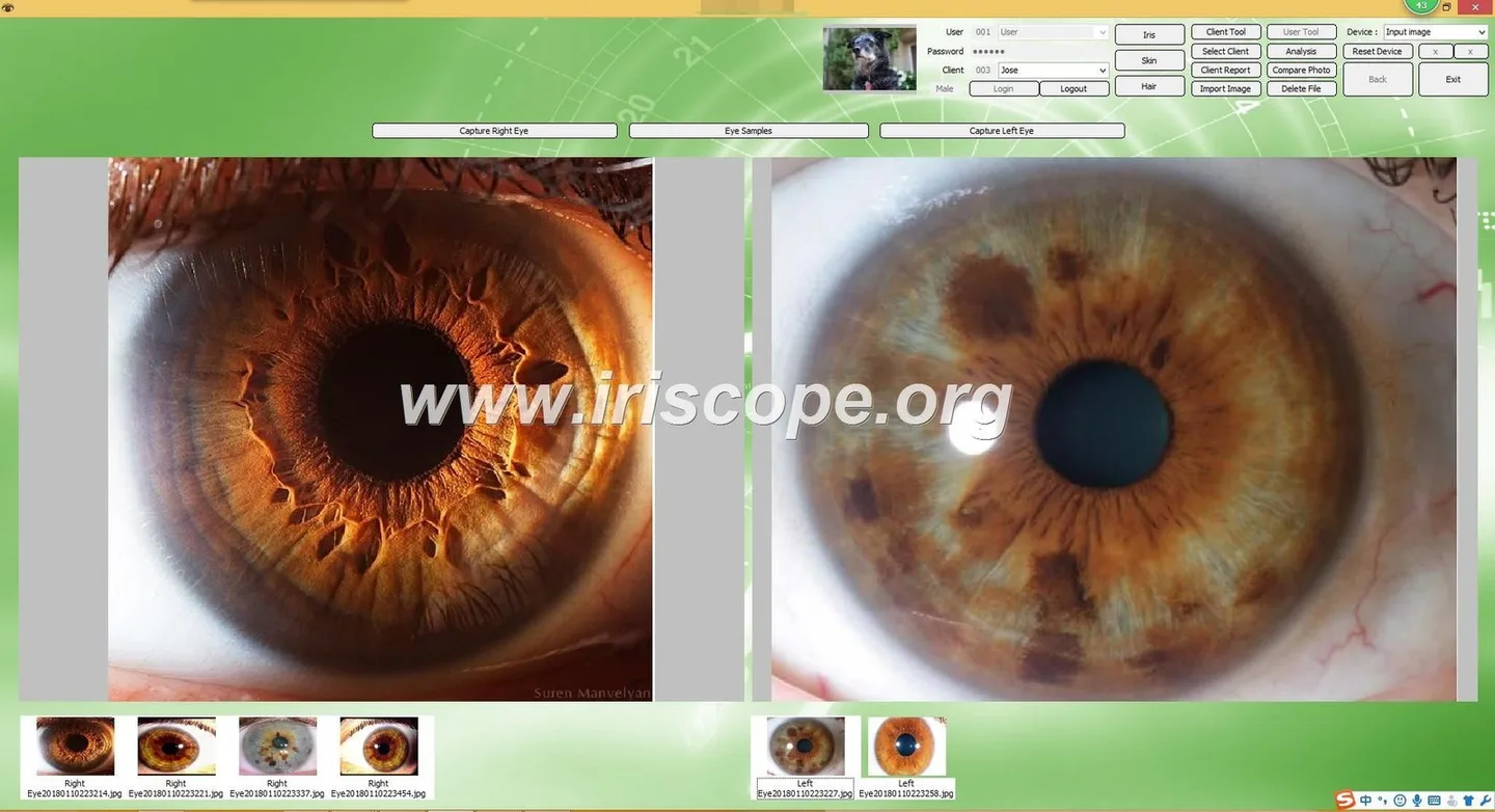 Corso di iridologia: cosa deve sapere un negozio di attrezzature professionali in Italia — MAIKONG IRIDOLOGY CAMERA (311).JPG