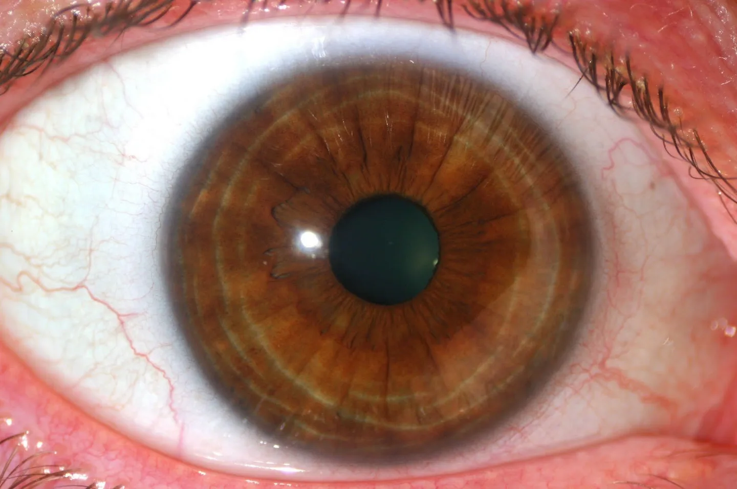 Corso di iridologia: cosa deve sapere un negozio di attrezzature professionali in Italia — MAIKONG IRIDOLOGY CAMERA (1482).jpg