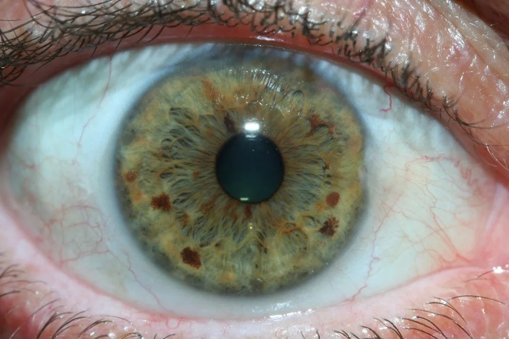 Corso di iridologia: cosa serve a un distributore di strumenti per naturopatia in Italia 5 Corso di iridologia: cosa serve a un distributore di strumenti per naturopatia in Italia — MAIKONG IRIDOLOGY CAMERA (1545).jpg