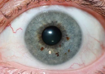Illuminazione ideale per fotografare l’iride: come evitare riflessi e artefatti 5 Illuminazione ideale per fotografare l’iride: come evitare riflessi e artefatti — MAIKONG IRIDOLOGY CAMERA (1555).jpg