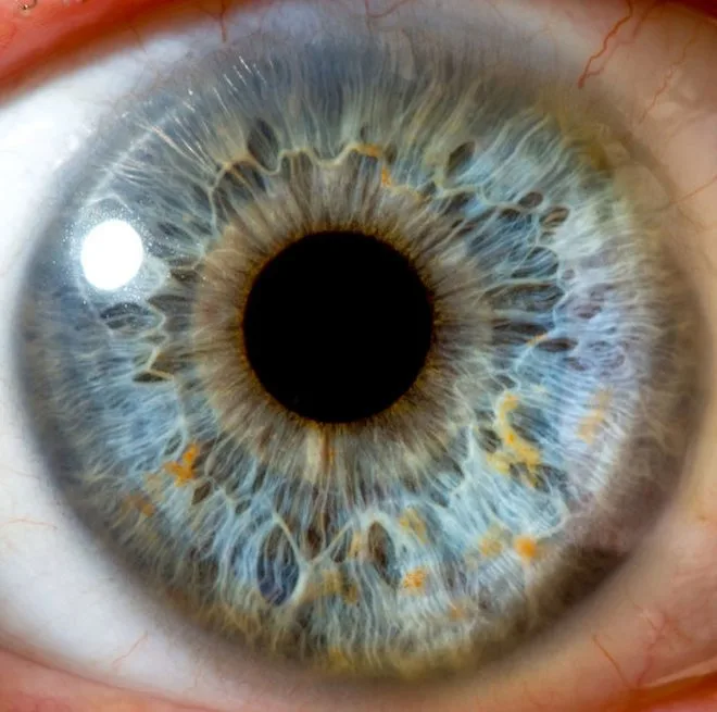 Illuminazione ideale per fotografare l’iride: come evitare riflessi e artefatti 4 Illuminazione ideale per fotografare l’iride: come evitare riflessi e artefatti — MAIKONG IRIDOLOGY CAMERA (648).jpg