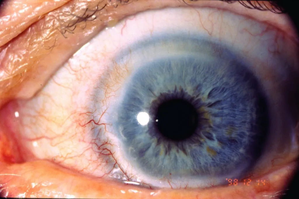 Illuminazione ideale per fotografare l’iride: come evitare riflessi e artefatti 6 Illuminazione ideale per fotografare l’iride: come evitare riflessi e artefatti — MAIKONG IRIDOLOGY CAMERA (1572).jpg
