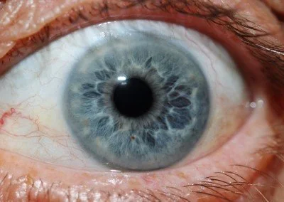 Illuminazione ideale per fotografare l’iride: come evitare riflessi e artefatti 1 Illuminazione ideale per fotografare l’iride: come evitare riflessi e artefatti — MAIKONG IRIDOLOGY CAMERA (1552).jpg