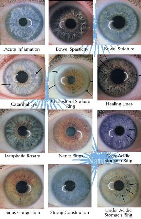 Master in Iridologia Oculistica: guida pratica per istituti di formazione e docenti in Italia — MAIKONG IRIDOLOGY CAMERA (1495).jpg