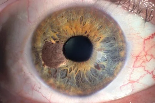 Master in iridologia oculistica: che cos’è, a chi serve e come scegliere strumenti e corsi 5 Master in iridologia oculistica: che cos’è, a chi serve e come scegliere strumenti e corsi — MAIKONG IRIDOLOGY CAMERA (1562).jpg
