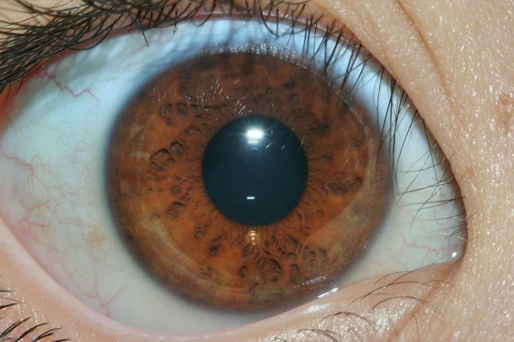 Vendita microscopio per iridologia: guida pratica per centri benessere in Italia 5 Vendita microscopio per iridologia: guida pratica per centri benessere in Italia — MAIKONG IRIDOLOGY CAMERA (1546).jpg